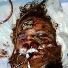 A hospitalized Kelly Thomas shortly before his death